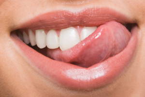 Teeth Cleaning at Haltom Dental